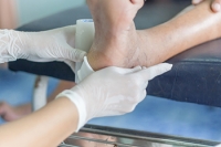 Diabetic Foot Ulcers and Podiatric Care
