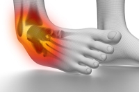 Understanding Ankle Sprains and Recovery